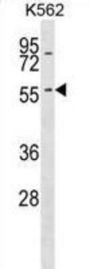 Keratin 6A (KRT6A) Antibody