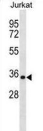 Heterogeneous Nuclear Ribonucleoprotein A1 (HNRNPA1) Antibody