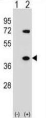 Heterogeneous Nuclear Ribonucleoprotein A1 (HNRNPA1) Antibody