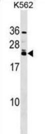 Heart And Neural Crest Derivatives Expressed Protein Protein 2 (HAND2) Antibody