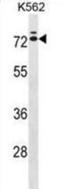Interleukin 23 Receptor (IL23R) Antibody
