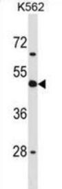 Antigen-Presenting Glycoprotein CD1d (CD1D) Antibody