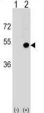 Antigen-Presenting Glycoprotein CD1d (CD1D) Antibody