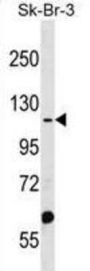 MTMR4 Antibody