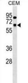 U1 Small Nuclear Ribonucleoprotein 70 kDa (SNRNP70) Antibody