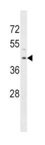 Ribonucleoside-Diphosphate Reductase Subunit M2 B (RRM2B) Antibody