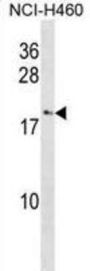 C-C Motif Chemokine 27 (CCL27) Antibody