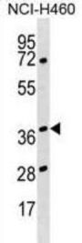 Heterogeneous Nuclear Ribonucleoprotein H3 (HNRNPH3) Antibody