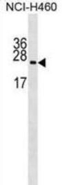RPL10A Antibody