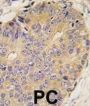 Bone Morphogenetic Protein 15 (BMP15) Antibody