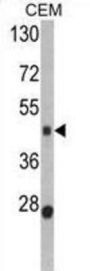 Bone Morphogenetic Protein 15 (BMP15) Antibody