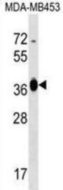 Glucose-Fructose Oxidoreductase Domain Containing 2 (GFOD2) Antibody
