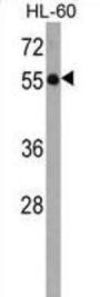 Kelch-Like Protein 3 (KLHL3) Antibody