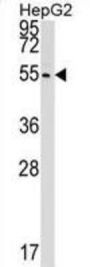 Polyribonucleotide 5'-Hydroxyl-Kinase Clp1 (CLP1) Antibody