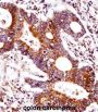 Carcinoembryonic Antigen Related Cell Adhesion Molecule 7 (CEACAM7) Antibody