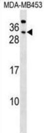 Carcinoembryonic Antigen Related Cell Adhesion Molecule 7 (CEACAM7) Antibody