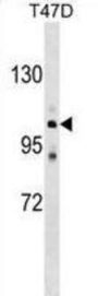 Calcium-Transporting ATPase Type 2C Member 1 (ATP2C1) Antibody