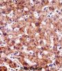 B-Cell CLL/Lymphoma 7B (BCL7B) Antibody