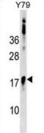 B-Cell CLL/Lymphoma 7B (BCL7B) Antibody