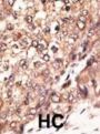 Bone Morphogenetic Protein 7 (Bmp7) Antibody