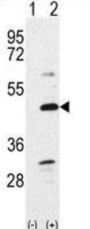 Bone Morphogenetic Protein 7 (Bmp7) Antibody