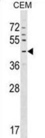 G Protein-Coupled Receptor 63 (GPR63) Antibody