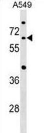 Cell Division Cycle 14A (CDC14A) Antibody