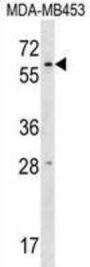 RNA Pseudouridylate Synthase Domain-Containing Protein 2 (RPUSD2) Antibody