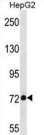 DEAD (Asp-Glu-Ala-Asp) Box Polypeptide 21 (DDX21) Antibody