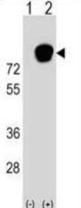 Heterogeneous Nuclear Ribonucleoprotein R (HNRNPR) Antibody