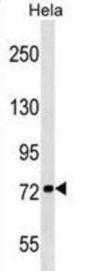 KIF3B Antibody