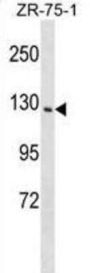 Phosphatidylinositol Transfer Protein Membrane Associated 1 (PITPNM1) Antibody