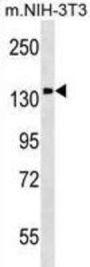 Phosphatidylinositol Transfer Protein Membrane Associated 1 (PITPNM1) Antibody