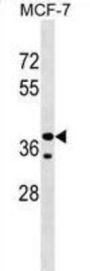 Collagen And Calcium-Binding EGF Domain-Containing Protein 1 (CCBE1) Antibody