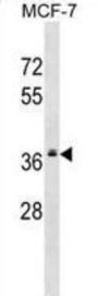 Mitochondrial Ribosomal Protein L2 (MRPL2) Antibody