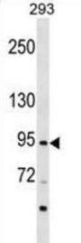 Zinc Finger Protein 341 (ZNF341) Antibody