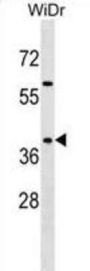 Synapse Associated Protein 1 (SYAP1) Antibody