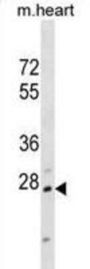 Homeobox Protein Hox-B1 (Hoxb1) Antibody