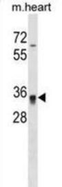 Homeobox Protein Hox-C8 (Hoxc8) Antibody