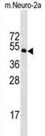 Mouse Stk39 Antibody