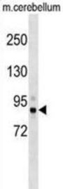 Serine/threonine-Protein Kinase TBK1 (Tbk1) Antibody