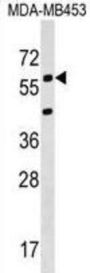Potassium Voltage-Gated Channel Subfamily S Member 3 (KCNS3) Antibody