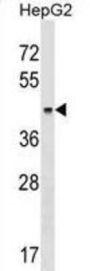 Keratin 23 (KRT23) Antibody
