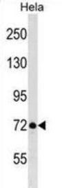 Ribosomal Biogenesis Protein LAS1L (LAS1L) Antibody