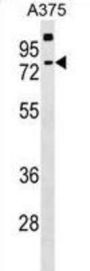 Transketolase-Like Protein 2 (TKTL2) Antibody
