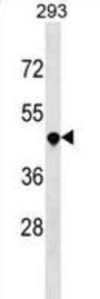 Tumor Necrosis Factor Receptor Superfamily, Member 25 (TNFRSF25) Antibody