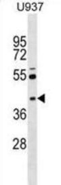 Src Kinase Associated Phosphoprotein 2 (SKAP2) Antibody