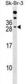 RAP2B, Member of RAS Oncogene Family (RAP2B) Antibody