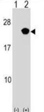 RAP2B, Member of RAS Oncogene Family (RAP2B) Antibody