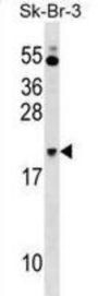 NKIRAS1 Antibody